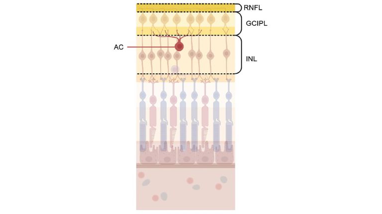 Retinale Nervenschicht (RNFL), Ganglienzell- und innere plexiforme Schicht (GCIPL), innere Körnerschicht (INL), und Amakrinzellen (AC) der Netzhaut. Die GCIPL, die synaptische Schicht der AC, war bei höherem genetischen Risiko für Schizophrenie dünner.