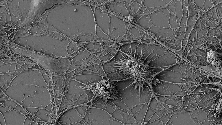 Mikroglia nutzen „tunneling nanotubes“ (TNTs), um direkte Verbindungen zu Neuronen herzustellen