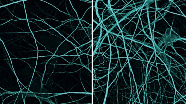 Die Forschenden haben ihre neuartige Methode an kultivierten menschlichen Nervenzellen getestet. Im Vergleich zu vorher (links) waren nach der Behandlung (rechts) deutlich mehr Nervenzellen vorhanden.